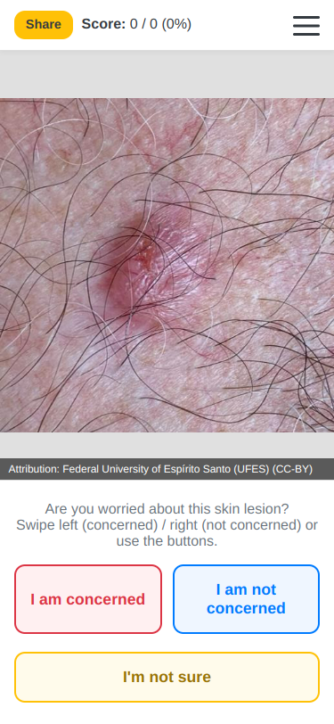 MoleCheck skin-lesion learning quiz mobile interface